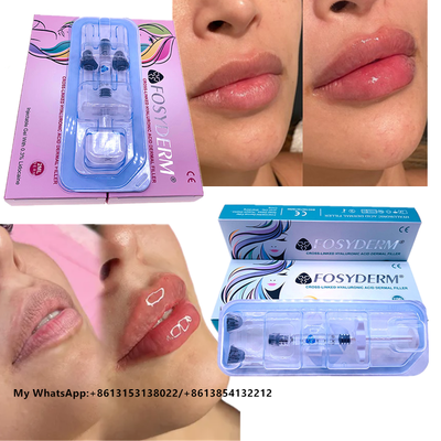 Fosyderm Injectable Hyaluronic Acid Dermal Filler for face Lips filler