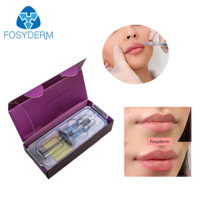 Juvederm Ultra 3 2*1ml Lidocaine Hyaluronic Injection