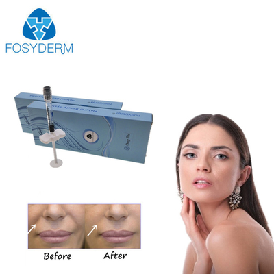 Facial Hyaluronic Acid Dermal Filler Lip Enhancer Ha Injection