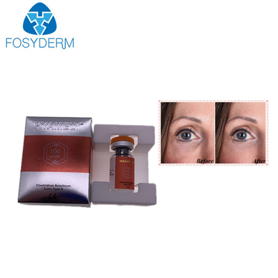 Botulinum Toxin Injection   Injection For Wrinkle Removal Powder Injection