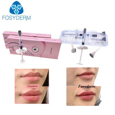 Cross Linked Injectable Hyaluronic Acid Filler For Lip Nose Fillers 1ml