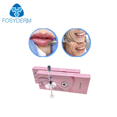 Fosyderm Injectable Hyaluronic Acid Dermal Filler For Lip Fullness Augmentation
