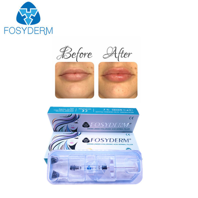 CE Certification 1ml Deep Hyaluronic Acid Derm HA Dermal Filler For Lips