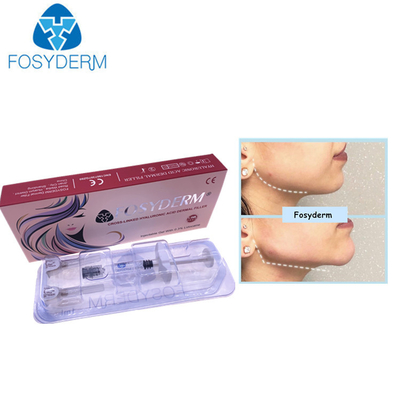 CE Approved 1ml Hyaluronic Acid Dermal Filler HA Injectable Double Chin