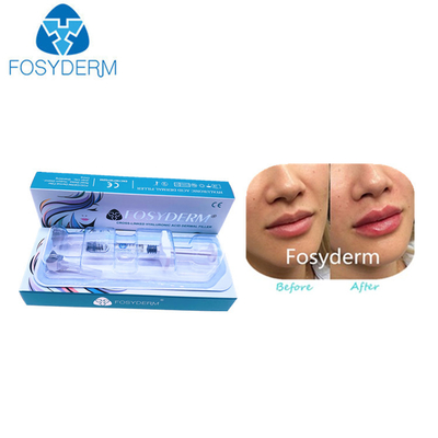 1ml Derm Hyaluronic Acid Dermal Filler For Lips CE Certification