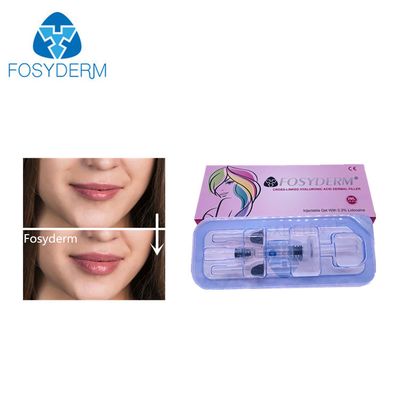 2ml HA Hyaluronic Acid Dermal Filler For Face Injection Lip Enlargement Syringe