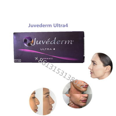 Lip Fullness Juvederm Ultra4 Allergan Dermal Filler Juvederm HA Fillers For Lips