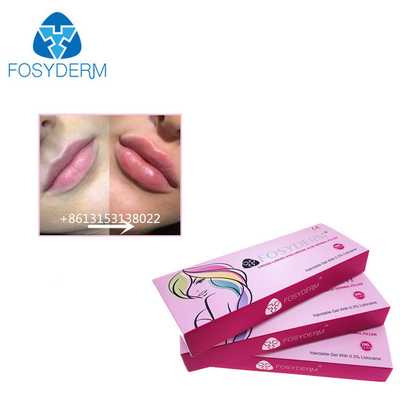 Fosyderm 1ml Hyaluronic Acid Dermal Filler Injections To Increase Lips Size