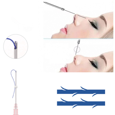 Nose PDO Thread Lift 19G Suture Hilos Cog L Needle Thread Lift Nose Up