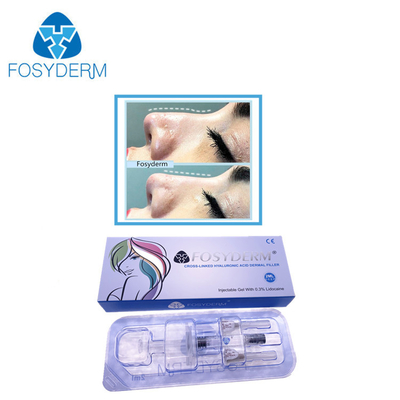 2 Ml Deep Line Hyaluronic Acid Dermal Filler Nose Up With Lidocaine