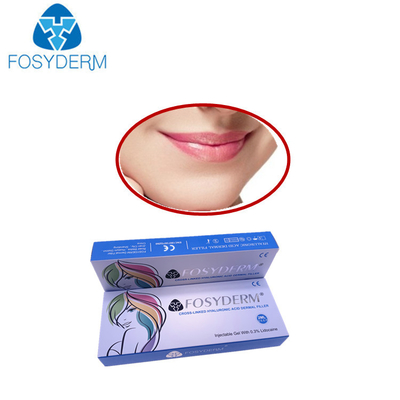 Smile Lines Hyaluronic Acid Dermal Filler Volume Derm Line Lyft Lidocaine Dermal Fillers