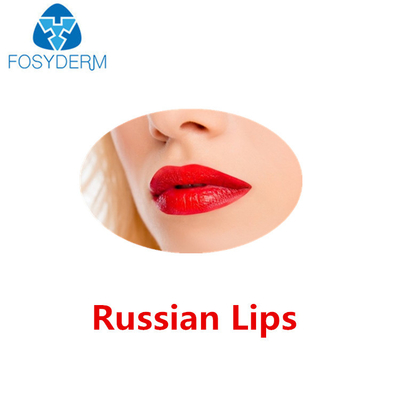 Juvederm Ultra 3 Hyaluronic Acid Dermal Filler Russian Lips With Lidocaine