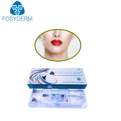 Facial Filling 1.1 Ml Cross Linked Dermal Filler Lip Filler Injections