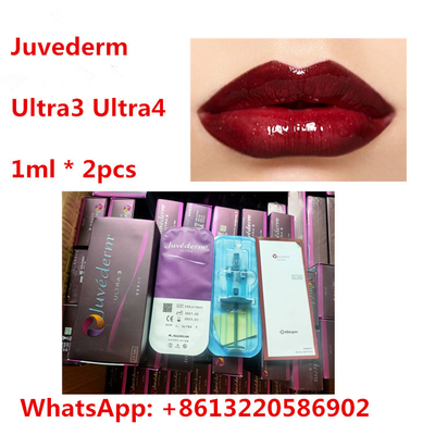 Juvederm Lip HA Dermal Filler With Lidocaine Ultra3 Ultra4