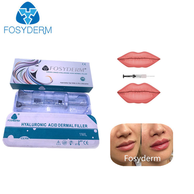 1ml Cross Linked Hyaluronic Acid Dermal Filler For Lips Nose Chin