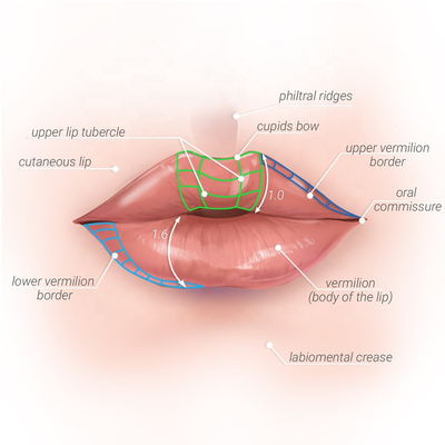 Injectable Hyaluronic Acid Dermal Lip Filler 1ml / 2ml