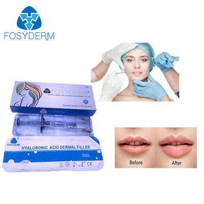 Cross Linked Dermal Filler Hyaluronic Acid 24mg 2ml For Facial Wrinkles