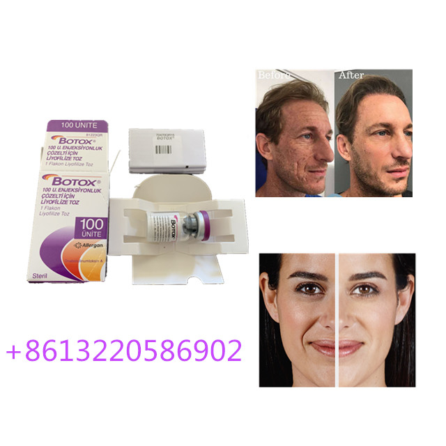 Anti Aging Allergan  Injection 100units Type A Anti Wrinkle