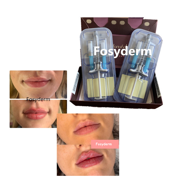 Juvederm Volbella Hyaluronic Acid Lips Filler Cross Linked 24mg