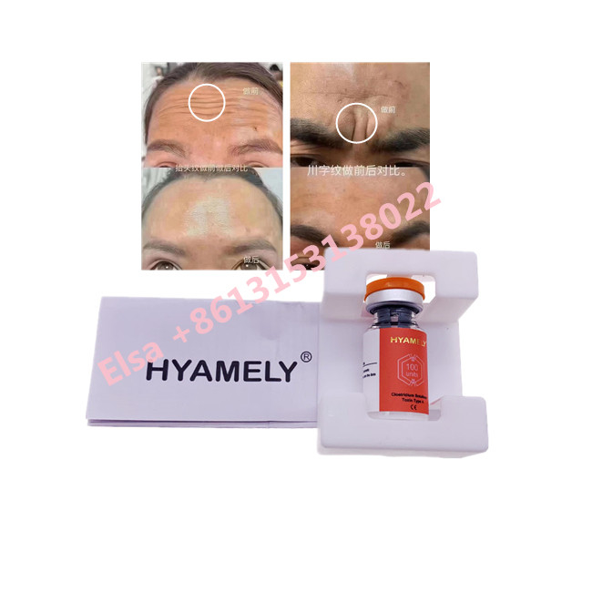 Hyamely  Botulinum Toxin Type A Korean  100u Cosmetic