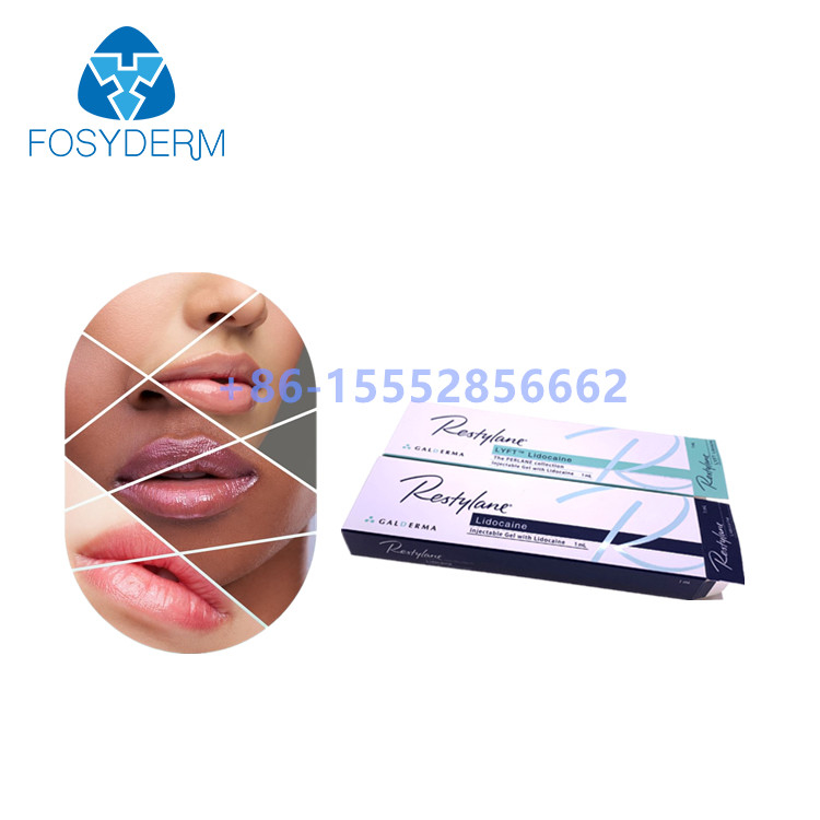 1ml Injectable Dermal Filler  Lip Enhancement Hyaluronic Acid