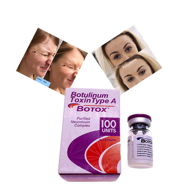 Allergan Botulinum Toxin Type A  100 Unit Dermal Filler Hyaluronic Acid