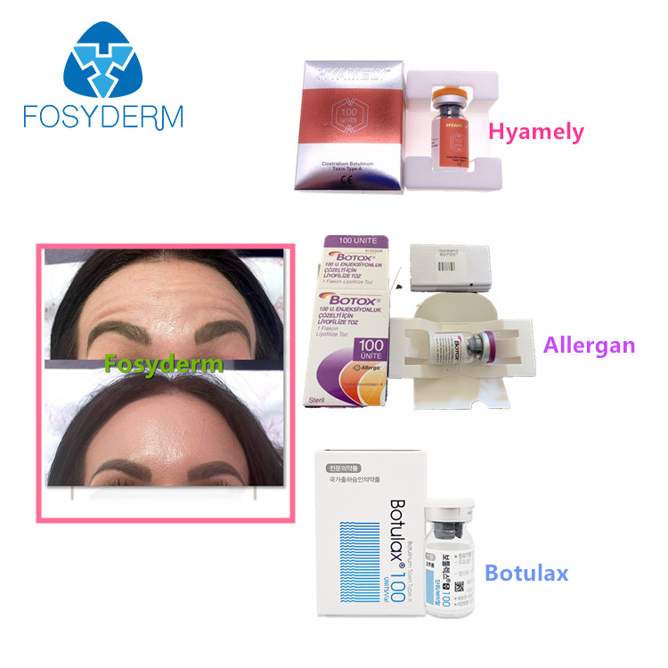 100 Units Type A Botulinum Toxin Allergan Anti Facial Wrinkles  Botulax Injection