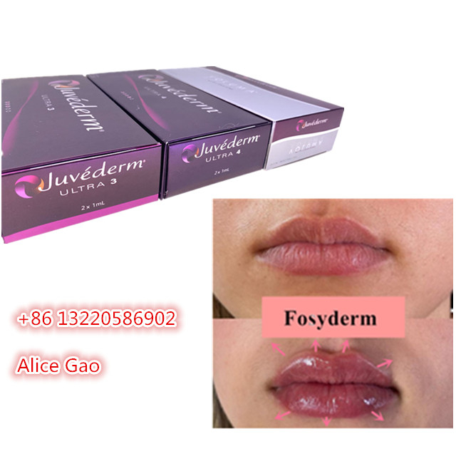 Juvederm Hyaluronic Acid Dermal Filler Lips Augmentation 24mg / Ml