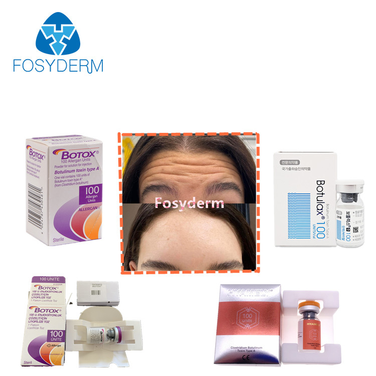 100units TypeA Botulinum Toxin Injection Anti Wrinkles  Allergan