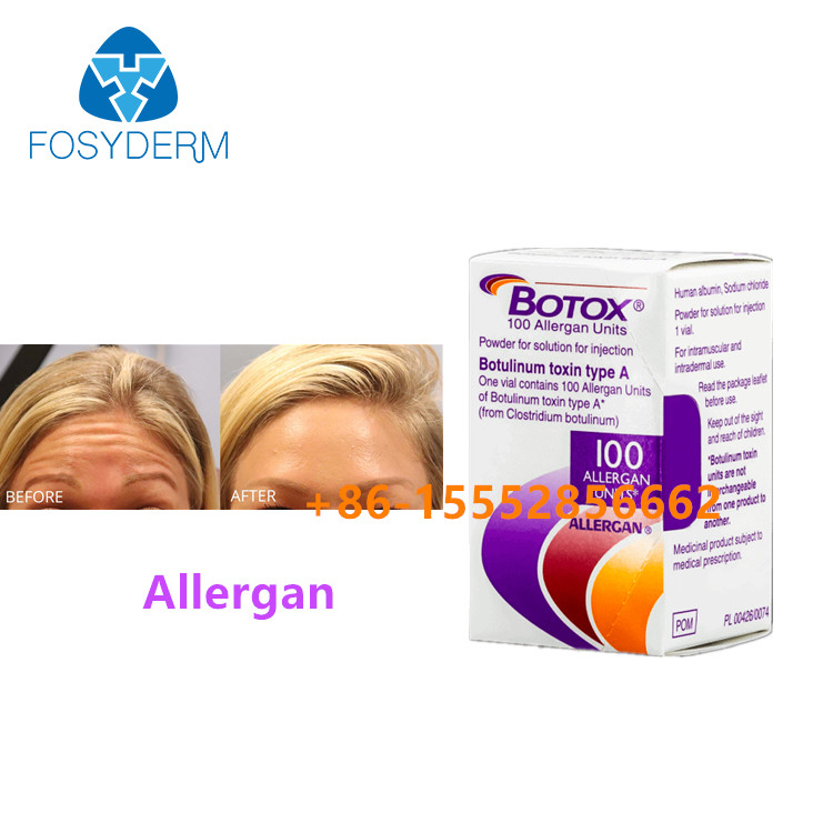 100units Botulinum Toxin Allergan Remove Facial Wrinkles Injection  Type A