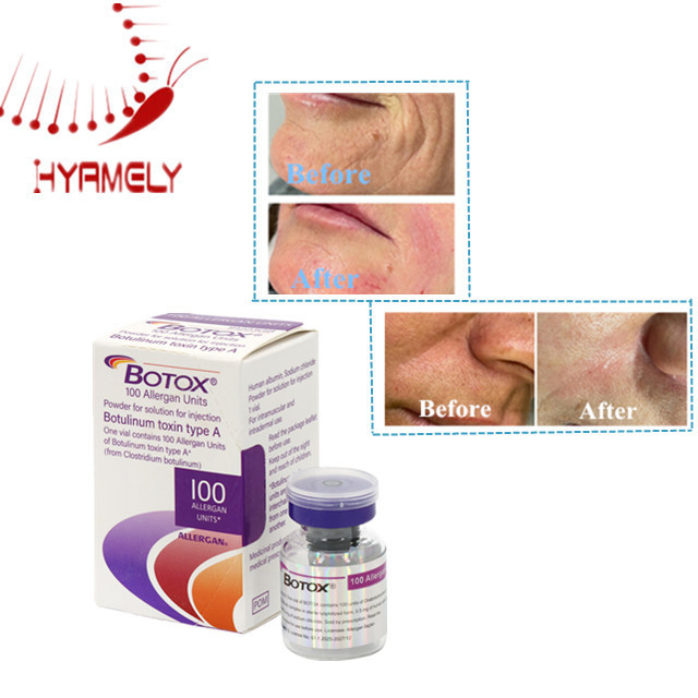 Wrinkle Removal Allergan Botulinum Toxin Type A 100 Units