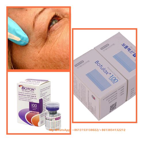 Best Effects Facial Fine Lines Removal Botulinum Toxin Allergan Botox 100 Units
