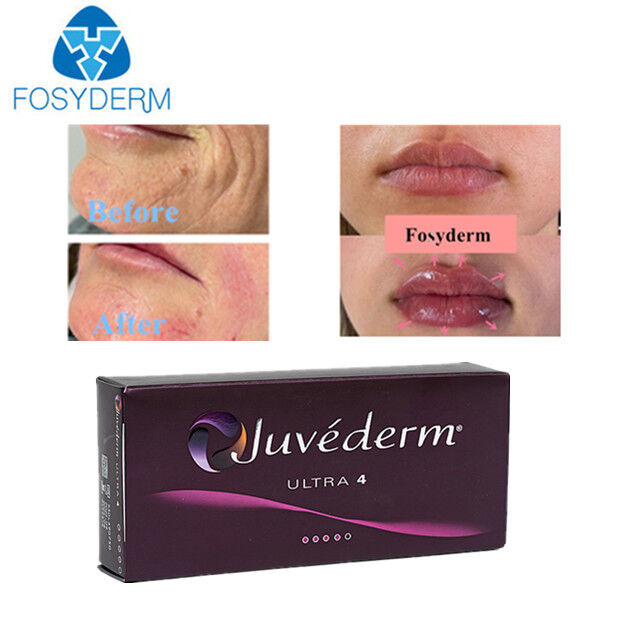 Juvederm Hyaluronic acid dermal filler facial filling 2ml