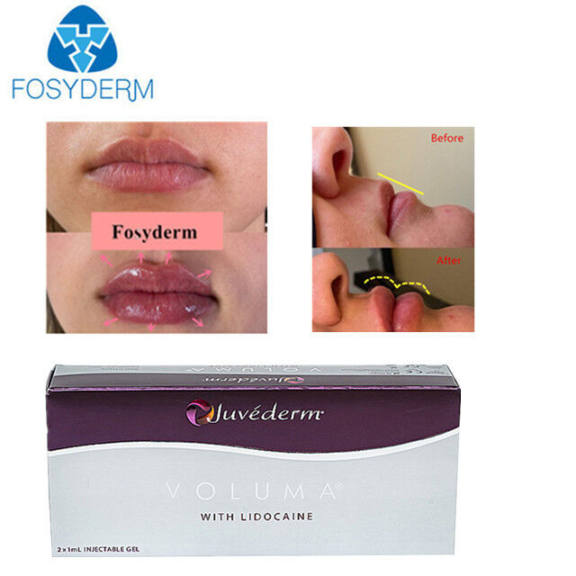 Juvederm Dermal Filler Premium HA Facial Injectable Gel 24mg