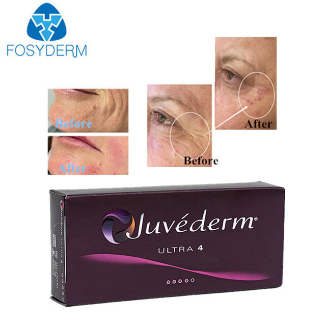 Juvederm Hyaluronic Acid Dermal Filler Face Anti Wrinkles 24mg