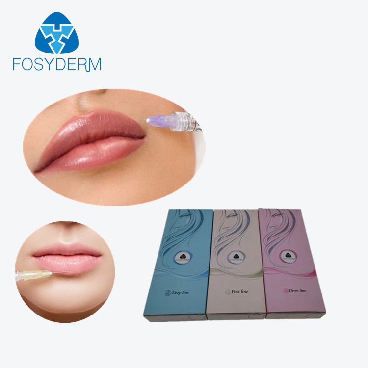 1ml Hyaluronic Acid Anti Wrinkle Dermal Fillers Face Contouring For Lips