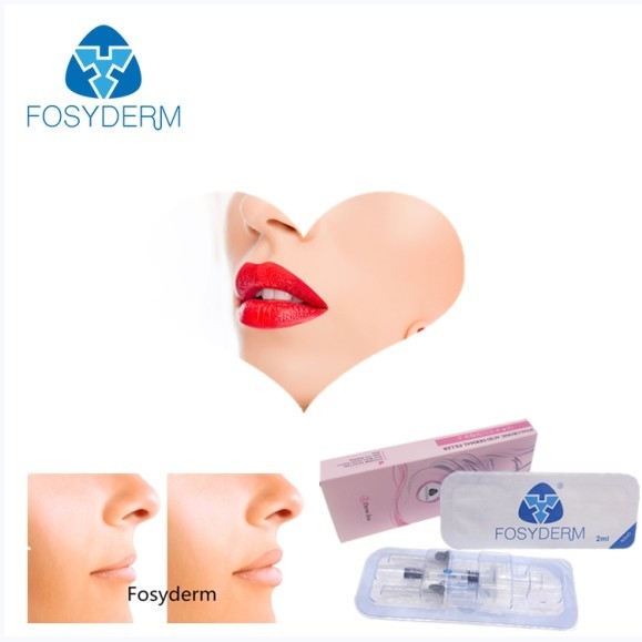 Gel Fosyderm 2ml Cross Linked Hyaluronic Acid Dermal Filler For Lip Enhancement