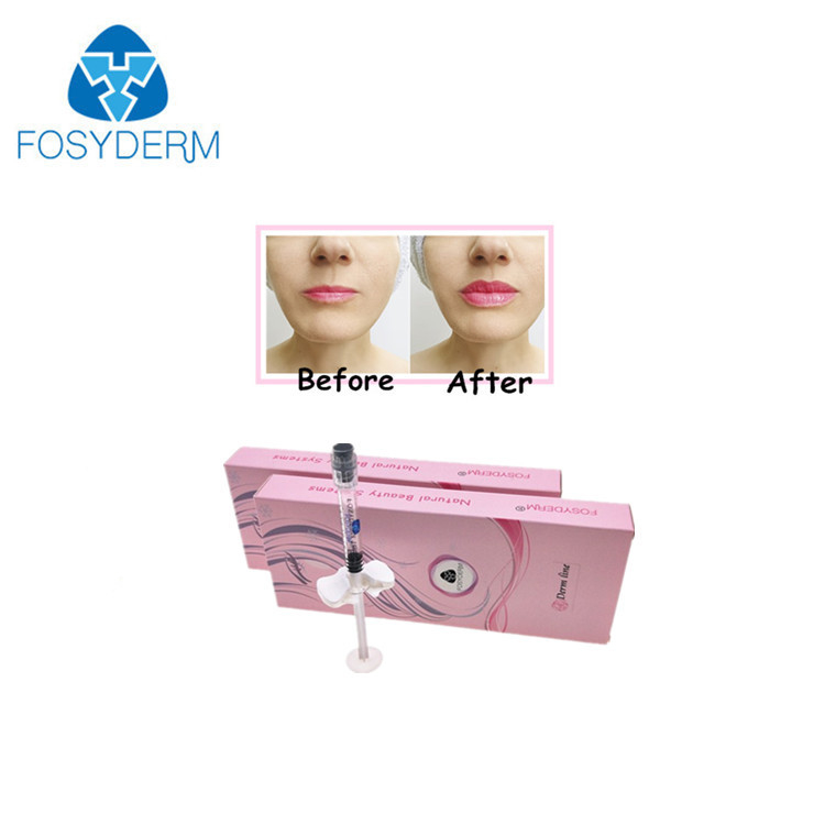 Lip Nose Chin Fullness Crosslinked HA Hyaluronic Acid Injectable Filler 24mg / Ml