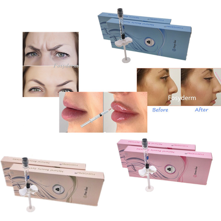 1ml 0.3 Lidocaine Lip Filler Hyaluronic Acid Injection