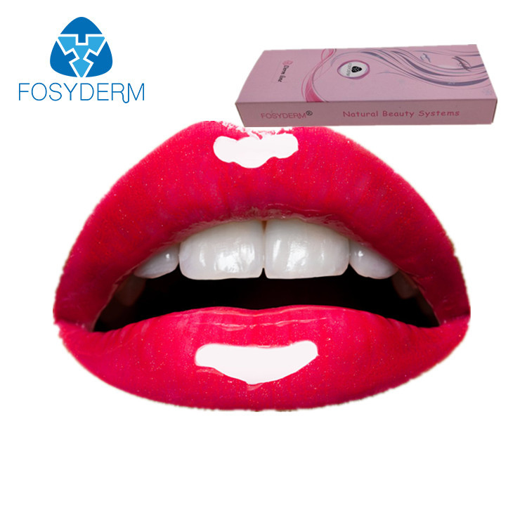 2ml Derm Hyaluronic Acid Filler Lidocaine , Lip Injections Fullness HA