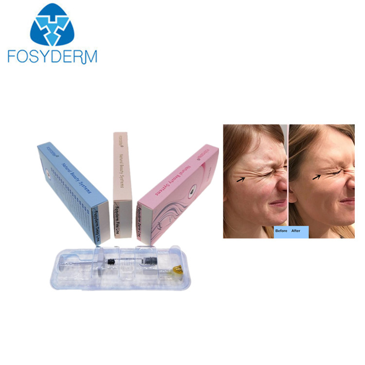 Gel Collagen Hyaluronic Acid Injectable Dermal Filler