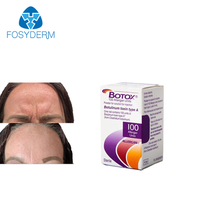 Anti Wrinkles  De Allergan 100 Units Injection