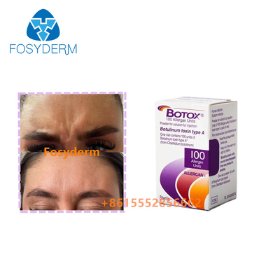 Remove Wrinkles Injection  Allergan Botulinum Toxin  Type A 100units