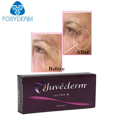 Juvederm Hyaluronic acid dermal filler facial filling Remove Wrinkles