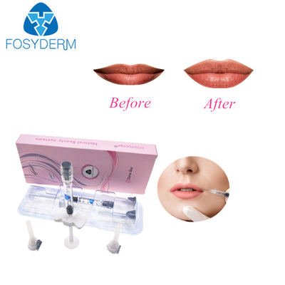 2ml Dermal Cross Linked Hyaluronic Pen Fillers
