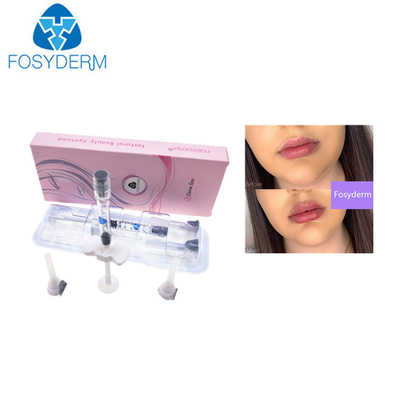 0.28mm HA Dermal Fillers Hyaluronic Acid 1ml Lip Injection
