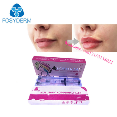 OEM Lip Enlargement Hyaluronic Acid Dermal Filler Gel Injection