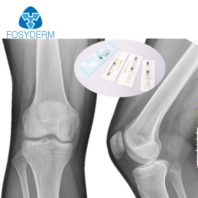 Non Cross Linked HA Joint Lubrication Injection , 3ml Knee Joint Gel