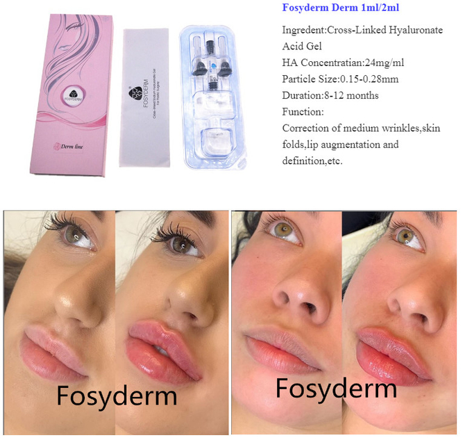 Fosyderm Hyaluronic Acid Injection Face 1ml 2ml 10ml 20ml 50ml Cross Linked