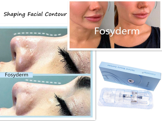 Facial Hyaluronic Acid Dermal Filler With Syringe For Lip Nose Chin